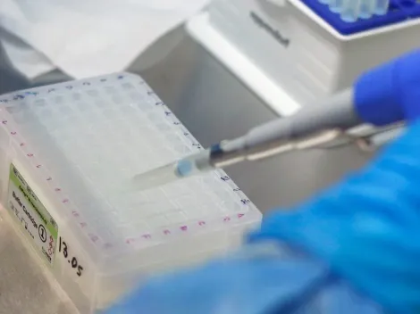 Seremi de Salud Metropolitana confirma 10 nuevos casos de variante Delta