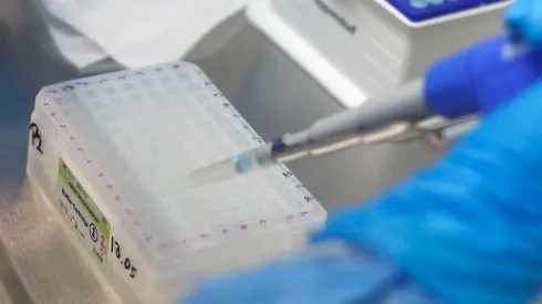 Seremi de Salud Metropolitana confirma 10 nuevos casos de variante Delta