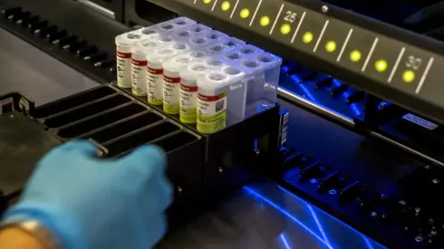 ¿Cuántos casos de Variante Delta hay en Chile?