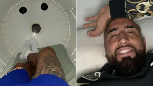 Vidal se recupera de su lesión soñando llegar a eliminatorias con Chile