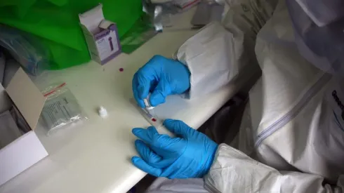 Conoce acá la lista de exámenes gratuitos disponibles en Isapres.