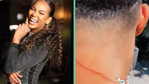 Betsy Camino y el rasguño en cuestión.