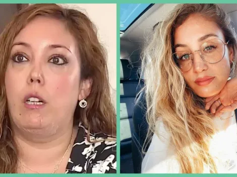 Mujer relata cómo la atacó el perro de Daniela Castro