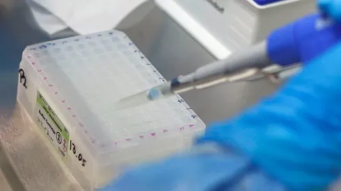 ¿Cuántos días tengo que hacer cuarentena si soy caso confirmado?