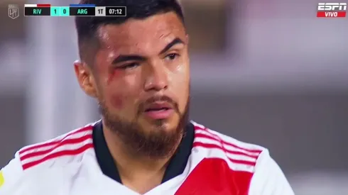 Paulo Díaz quedó con evidentes marcas del encontronazo con Gabriel Ávalos.