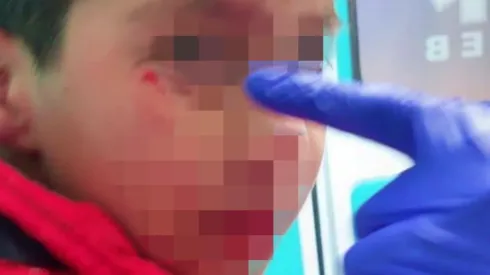 La madre de Thiago pidió justicia tras ser alcanzado por una bengala.