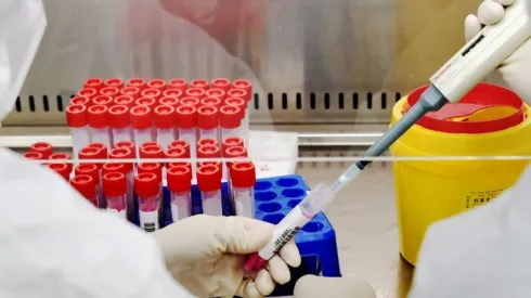 Conoce aquí la actualidad de la pandemia.