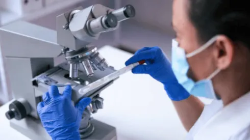 ¿Qué dijo la OMS sobre la Viruela del mono?