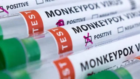 Revisa aquí los dichos del Minsal sobre la enfermedad.