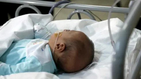 ¿Cuáles son los síntomas del virus Sincicial?