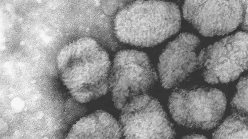 Imagen Microscópica de viruela del mono