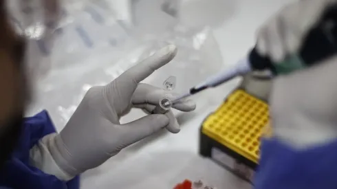 Viruela del Mono: Síntomas y método de contagio