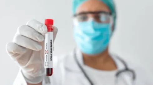 ¿De dónde proviene la viruela del mono?