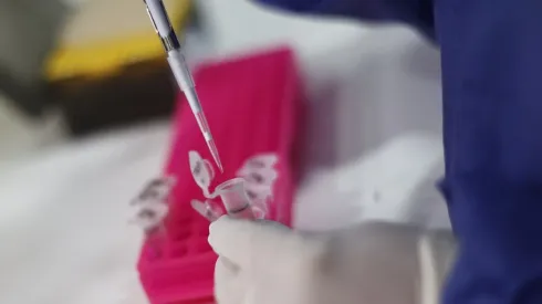 El Minsal anunció un nuevo caso de Viruela del Mono.