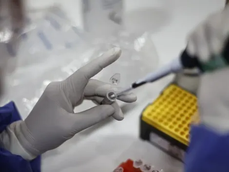 Viruela del Mono | ¿Cuáles son los síntomas y cómo se contagia?
