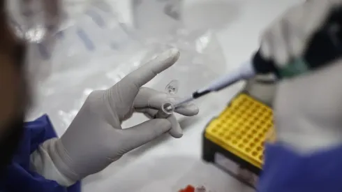 Método de contagio y síntomas de la viruela del mono