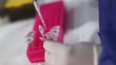 Viruela del mono: síntomas y medio de contagio