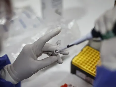 ¿Cuáles son los síntomas de la viruela del mono y qué es la alerta sanitaria?