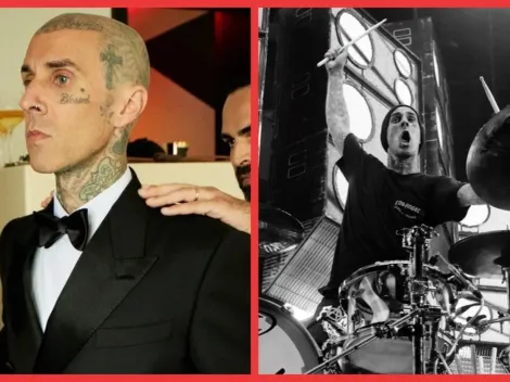 Travis Barker está hospitalizado grave