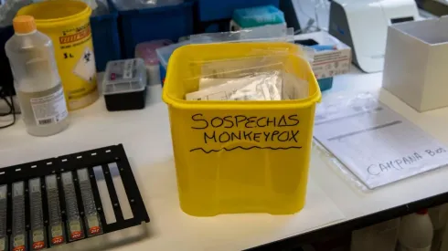 ¿Cómo se contagia la Viruela del Mono?