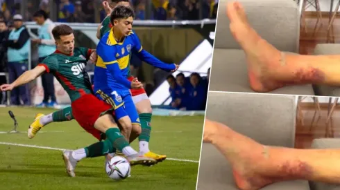 Exequiel Zeballos está recuperándose para volver en 2023.