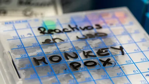 ¿Cuáles son los síntomas más comunes de la Viruela del Mono y cómo se contagia?