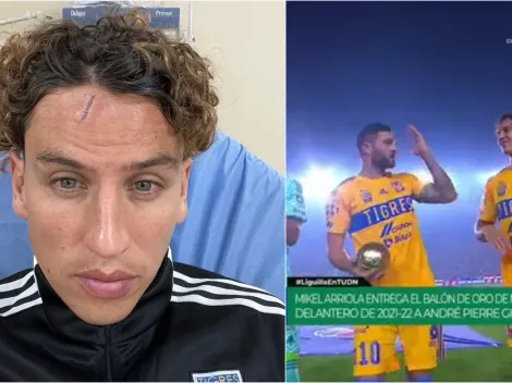 Lichnovsky hace enojar a Gignac, es figura y queda a lo Frankestein