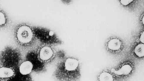 ¿Cuáles son los síntomas del "Perro del Infierno" del Covid-19?