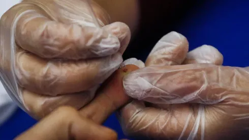 Vacuna experimental contra el VIH muestra prometedores resultados