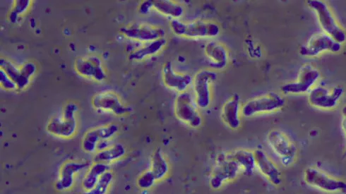 La Naegleria fowleri o ameba comecerebros bajo el microscopio.