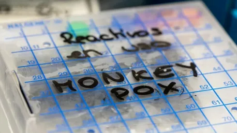 Enfermedades que dejarán de ser emergencia en 2023