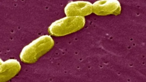 ¿Qué es la Burkholderia cepacia que ha dejado 35 personas fallecidas en Chile?