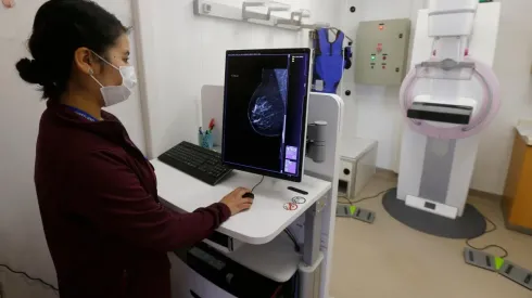 Mamografías gratuitas