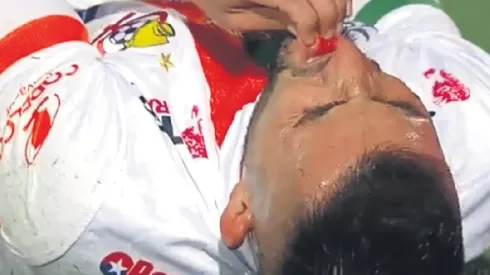 Nelson Sepúlveda yace con su labio roto.