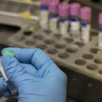 ¿Dónde son más baratos los exámenes de laboratorio en Santiago?