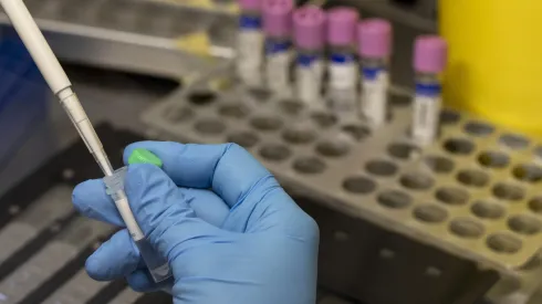 Valores de exámenes de laboratorio.