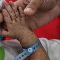 Regreso del sarampión a Chile ¿Quiénes son los grupos de riesgo?