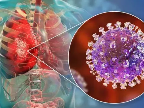 ¿Qué es el virus Nipah y cómo se transmite?