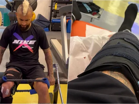 Vidal muestra su rodilla operada y deja un aviso