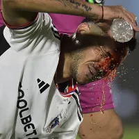 Ramiro González calma a los hinchas de Colo Colo tras su aterrador corte ante Rosario Central