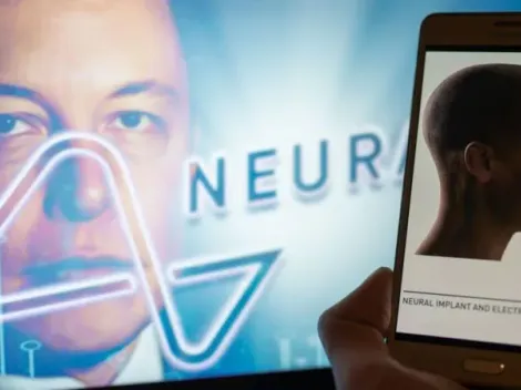 ¡Como en Black Mirror! Elon Musk lanza novedoso chip cerebral