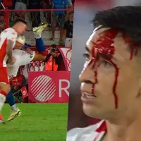 ¡Brutal! Rodrigo Echeverría termina todo ensangrentado en el clásico Huracán-San Lorenzo