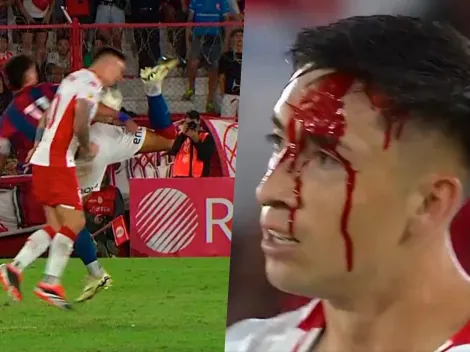 Eche termina todo lleno el sangre el clásico ante San Lorenzo