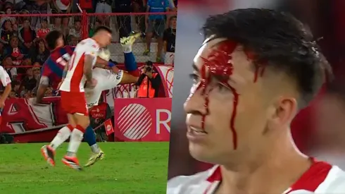 Echeverría sufrió un duro golpe en el clásico ante San Lorenzo.