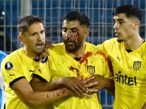 Hinchas de Rosario le rompen la cara a jugador de Peñarol