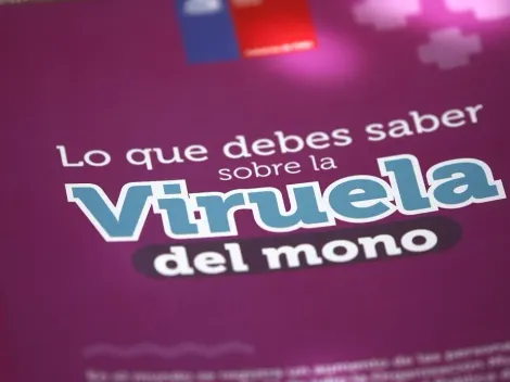 Los detalles sobre el nuevo caso de viruela del mono en Chile