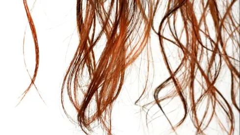 Caída de cabello por reconocida marca de shampoo.