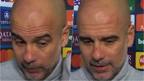 Pep Guardiola sorprendió al mundo con sus cortes en la cara tras empate del Manchester City.