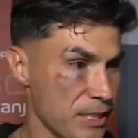 Pablo Galdames queda a lo Rocky tras el clásico de Avellaneda y enciende la polémica: “Imagino que fue…”