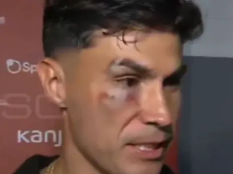 Galdames queda a lo Rocky y enciende polémica en el clásico